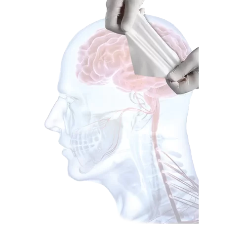 Membrana de colágeno DURAMATRIX