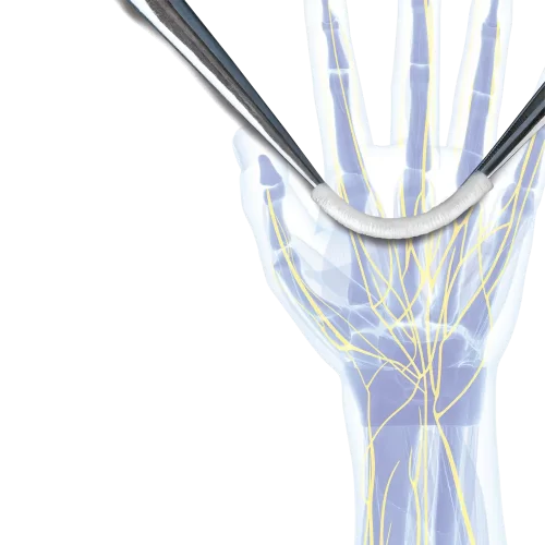 Conducto de colágeno NEUROFLEX